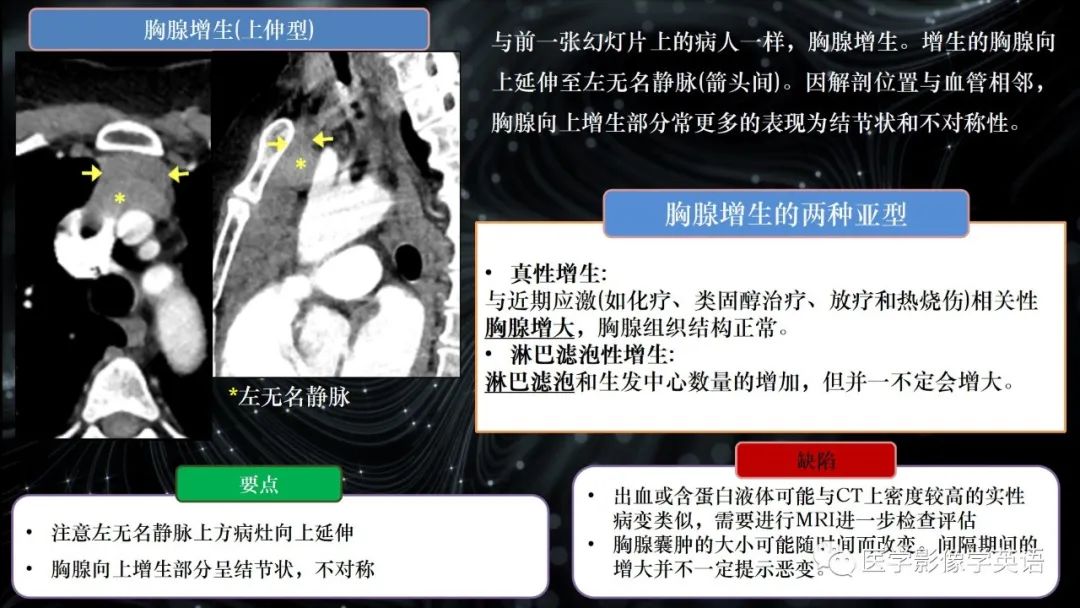 影像PPT - 【PPT】前纵隔肿块诊断要点及缺陷-44 影像PPT - 【PPT】前纵隔肿块诊断要点及缺陷-44
