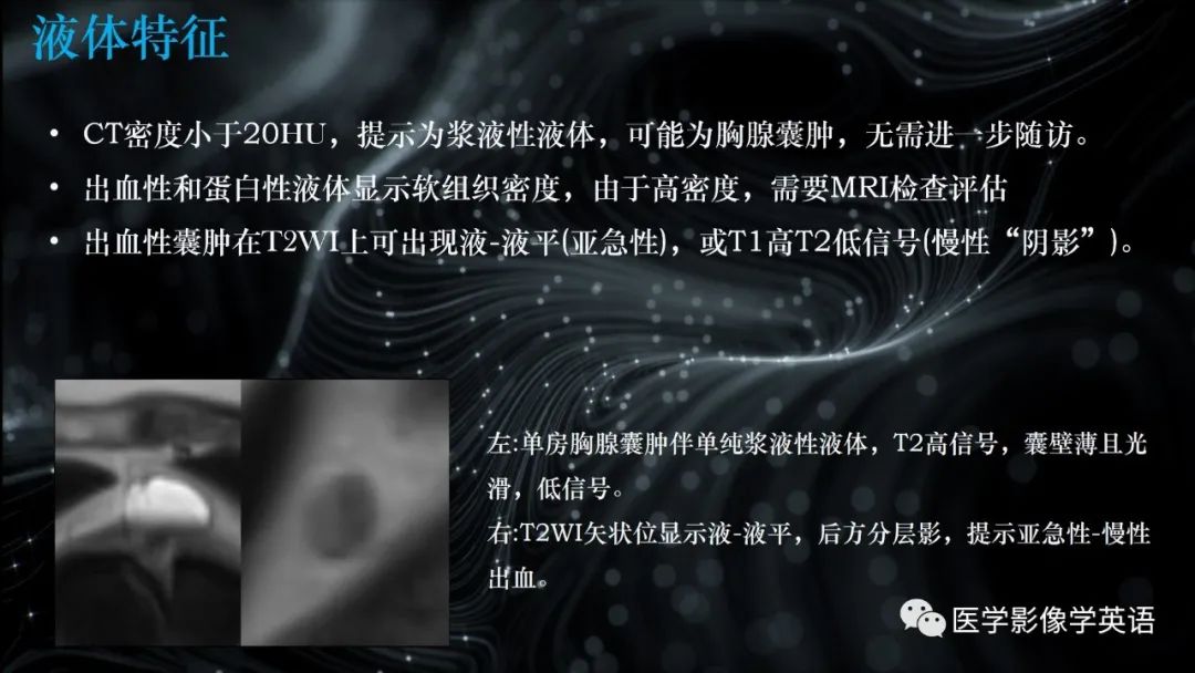 影像PPT - 【PPT】前纵隔肿块诊断要点及缺陷-54 影像PPT - 【PPT】前纵隔肿块诊断要点及缺陷-54