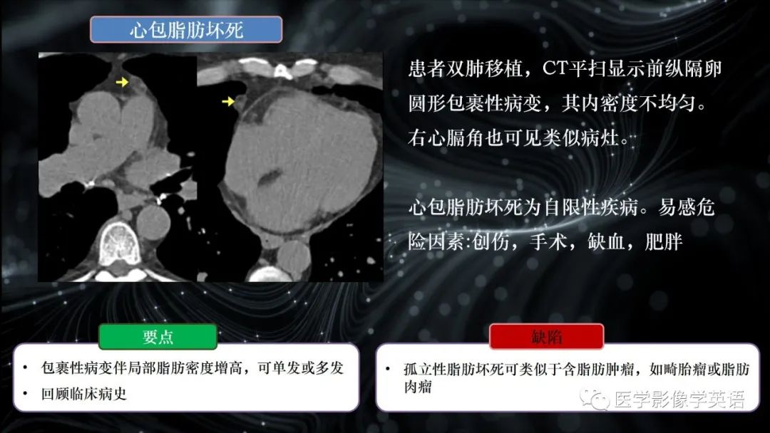 影像PPT - 【PPT】前纵隔肿块诊断要点及缺陷-60 影像PPT - 【PPT】前纵隔肿块诊断要点及缺陷-60