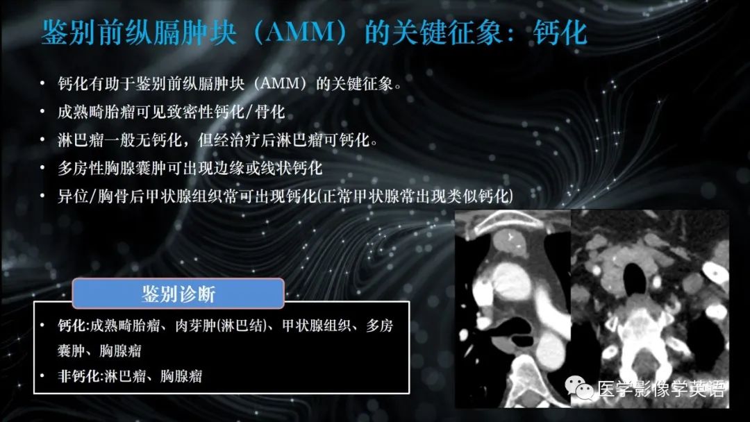 影像PPT - 【PPT】前纵隔肿块诊断要点及缺陷-62 影像PPT - 【PPT】前纵隔肿块诊断要点及缺陷-62