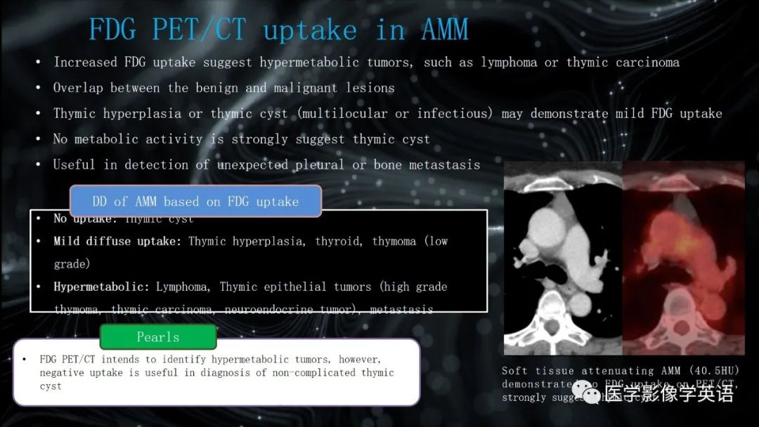 影像PPT - 【PPT】前纵隔肿块诊断要点及缺陷-63 影像PPT - 【PPT】前纵隔肿块诊断要点及缺陷-63