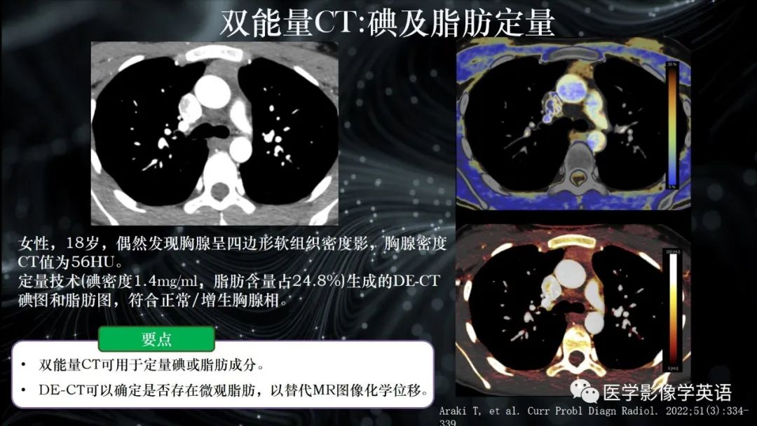 影像PPT - 【PPT】前纵隔肿块诊断要点及缺陷-68 影像PPT - 【PPT】前纵隔肿块诊断要点及缺陷-68
