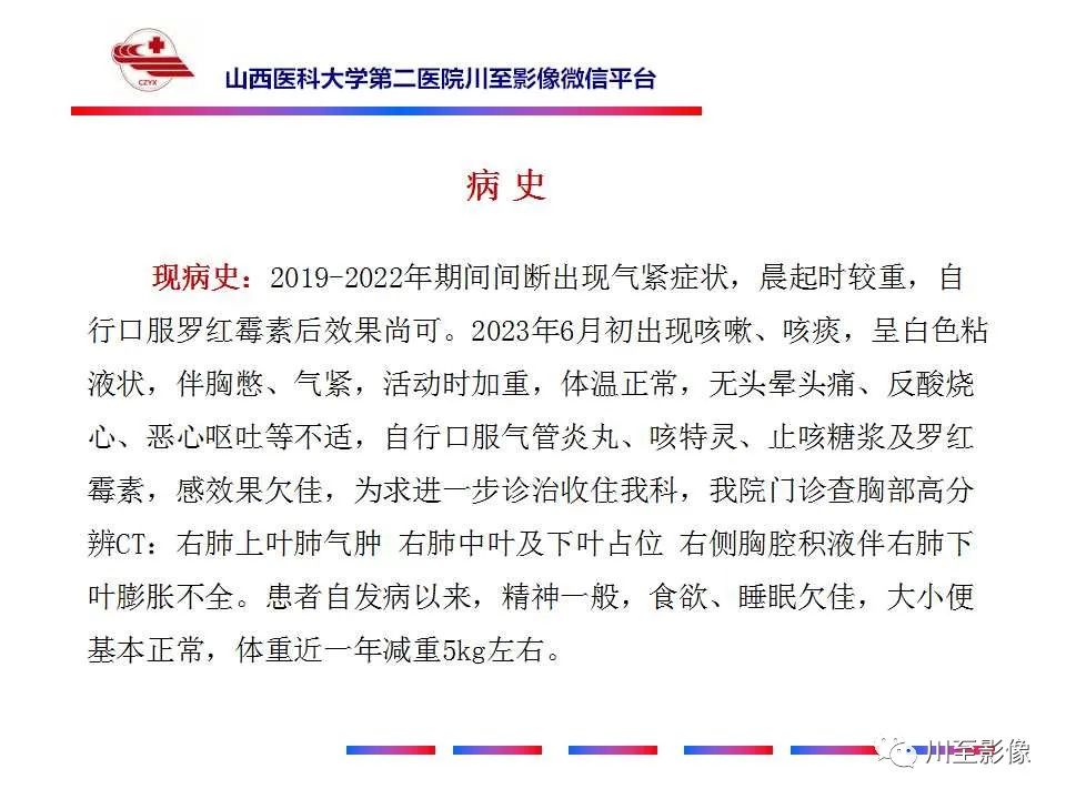 影像PPT - 【PPT】周围型肺癌-3