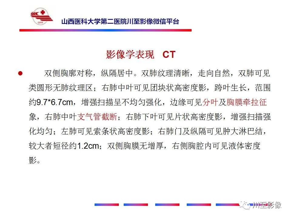 影像PPT - 【PPT】周围型肺癌-6