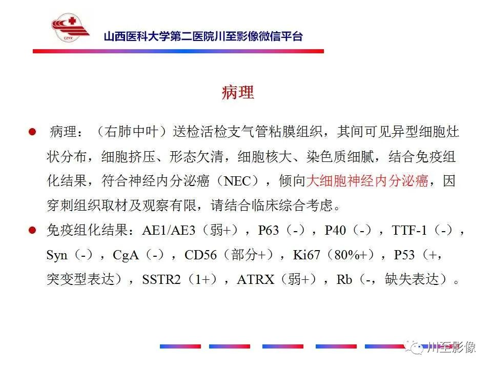 影像PPT - 【PPT】周围型肺癌-8
