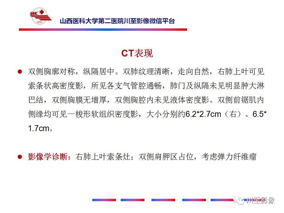影像PPT - 【PPT】弹力纤维瘤-5