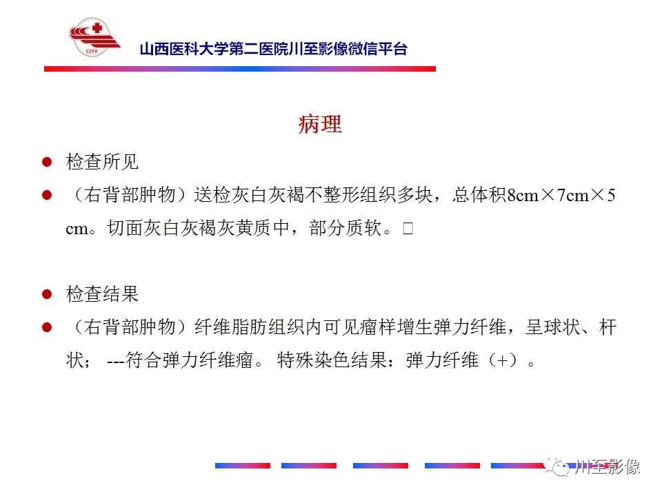 影像PPT - 【PPT】弹力纤维瘤-6