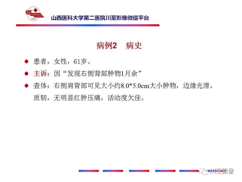 影像PPT - 【PPT】弹力纤维瘤-7