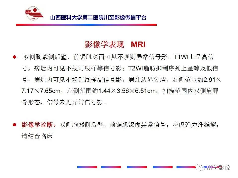 影像PPT - 【PPT】弹力纤维瘤-10