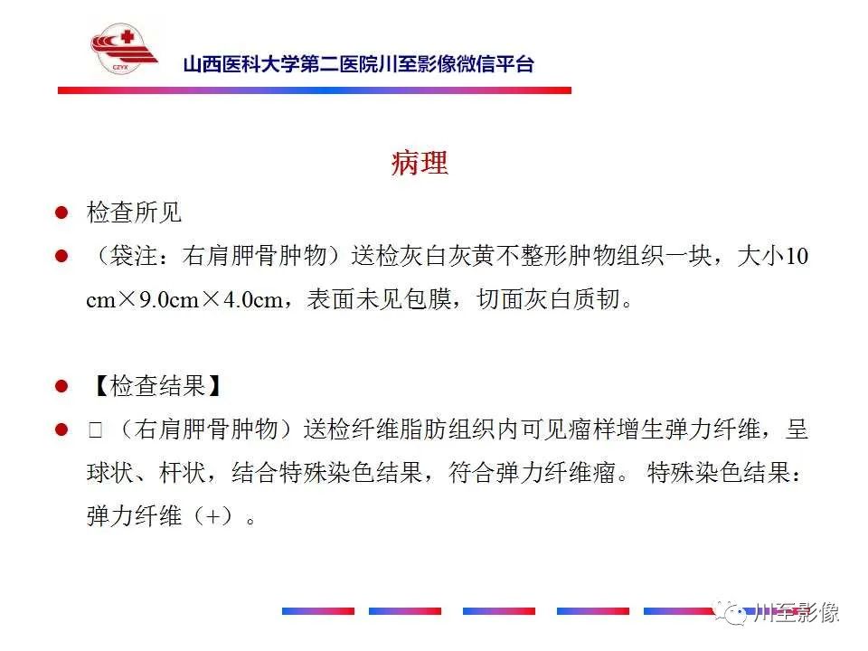 影像PPT - 【PPT】弹力纤维瘤-11