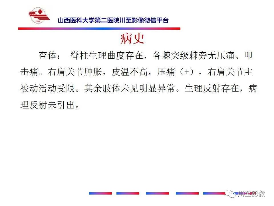 影像PPT - 【病例】肱骨动脉瘤样骨囊肿1例X线CT及MR影像-3 影像PPT - 【病例】肱骨动脉瘤样骨囊肿1例X线CT及MR影像-3