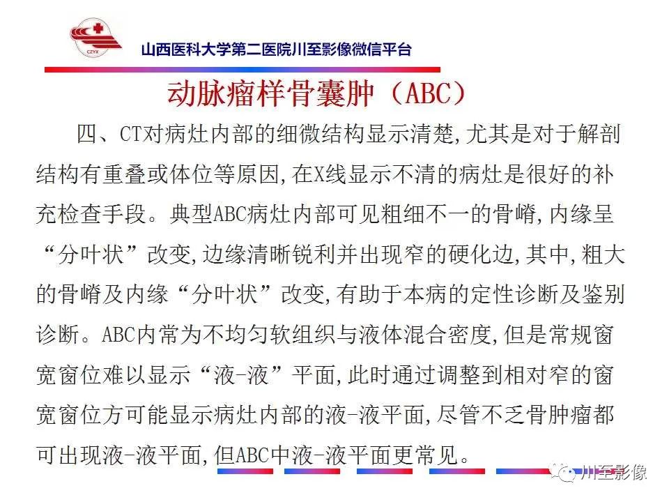 影像PPT - 【病例】肱骨动脉瘤样骨囊肿1例X线CT及MR影像-21 影像PPT - 【病例】肱骨动脉瘤样骨囊肿1例X线CT及MR影像-21