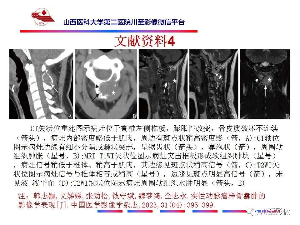 影像PPT - 【病例】肱骨动脉瘤样骨囊肿1例X线CT及MR影像-38 影像PPT - 【病例】肱骨动脉瘤样骨囊肿1例X线CT及MR影像-38