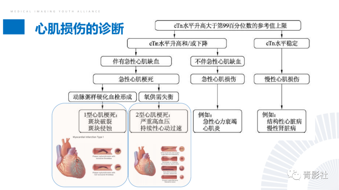 影像PPT - 【PPT】CMR在非冠状动脉阻塞性急性心肌损伤中的价值-5