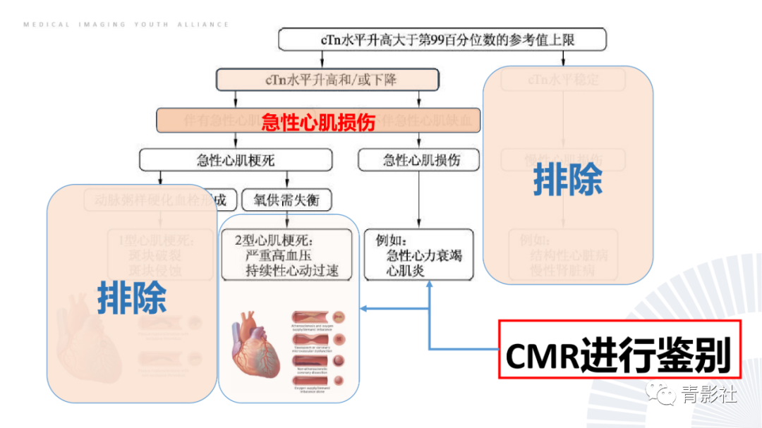 影像PPT - 【PPT】CMR在非冠状动脉阻塞性急性心肌损伤中的价值-11