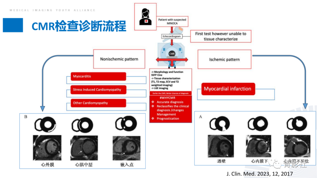 影像PPT - 【PPT】CMR在非冠状动脉阻塞性急性心肌损伤中的价值-15