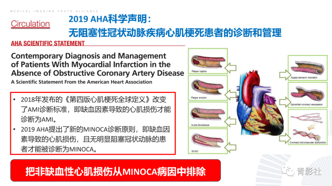 影像PPT - 【PPT】CMR在非冠状动脉阻塞性急性心肌损伤中的价值-18