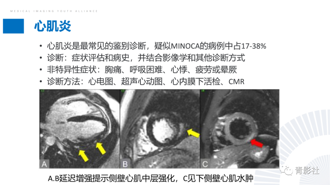 影像PPT - 【PPT】CMR在非冠状动脉阻塞性急性心肌损伤中的价值-24