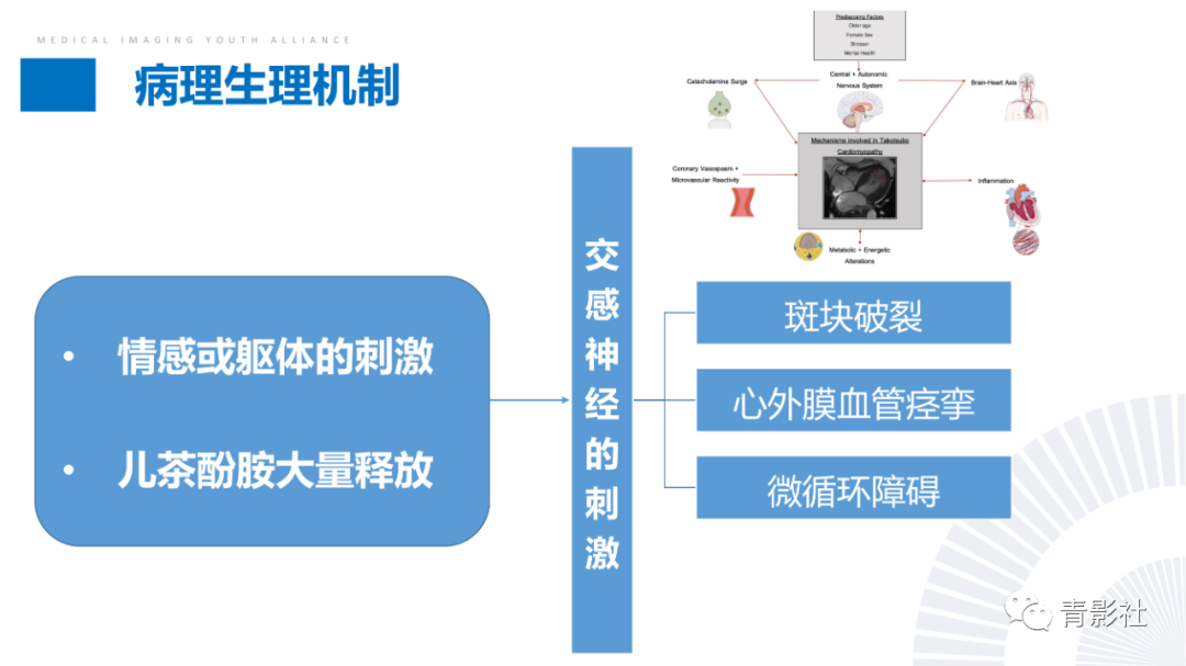 影像PPT - 【PPT】CMR在非冠状动脉阻塞性急性心肌损伤中的价值-43