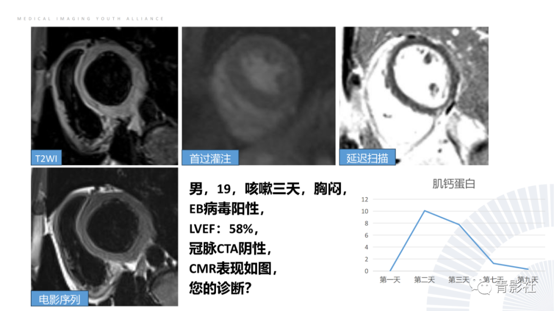 影像PPT - 【PPT】CMR在非冠状动脉阻塞性急性心肌损伤中的价值-55