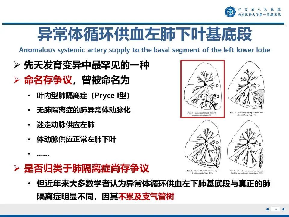 影像PPT - 【PPT】异常体循环供血左肺下叶基底段-20