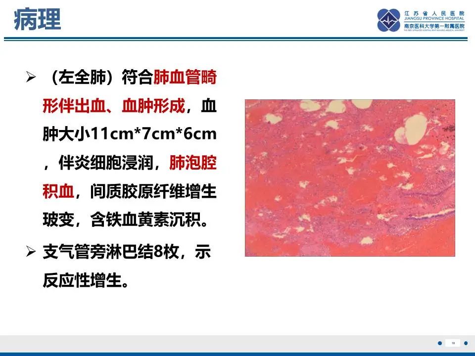 影像PPT - 【PPT】异常体循环供血左肺下叶基底段-19