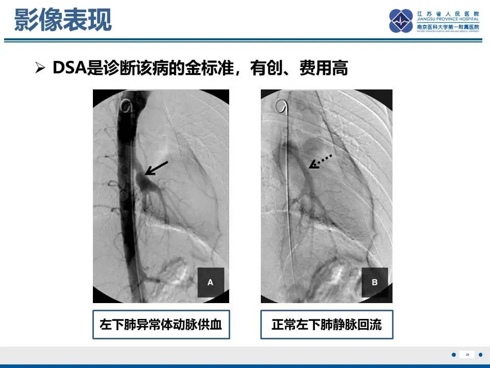 影像PPT - 【PPT】异常体循环供血左肺下叶基底段-26