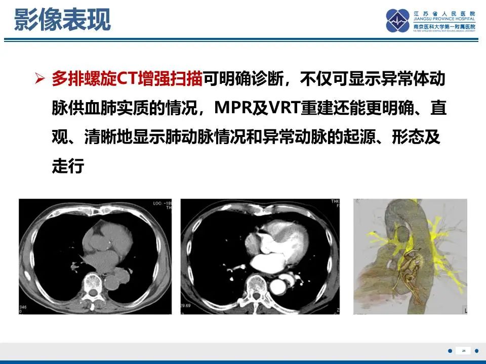 影像PPT - 【PPT】异常体循环供血左肺下叶基底段-27