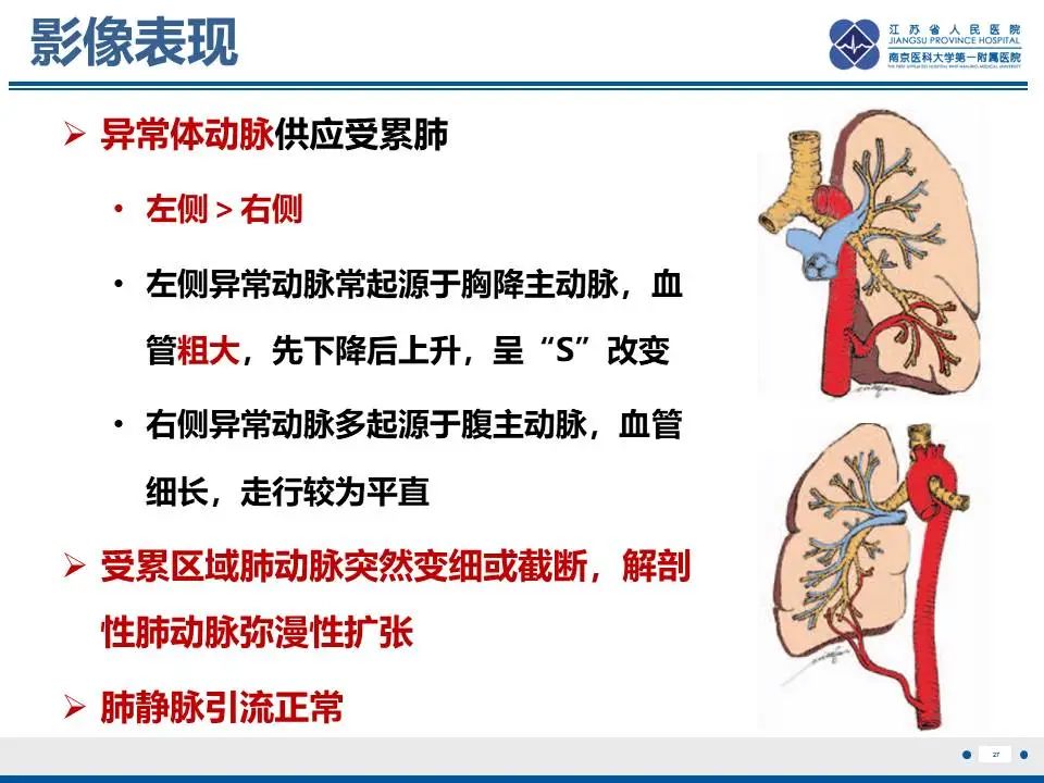 影像PPT - 【PPT】异常体循环供血左肺下叶基底段-28