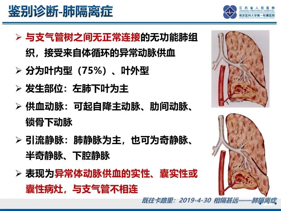影像PPT - 【PPT】异常体循环供血左肺下叶基底段-31