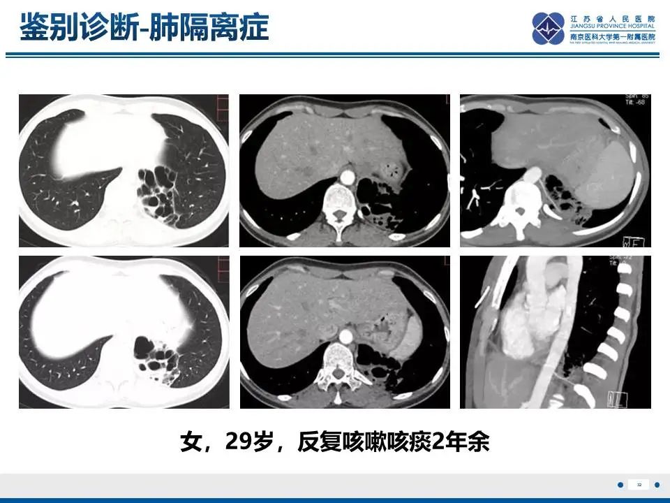 影像PPT - 【PPT】异常体循环供血左肺下叶基底段-33