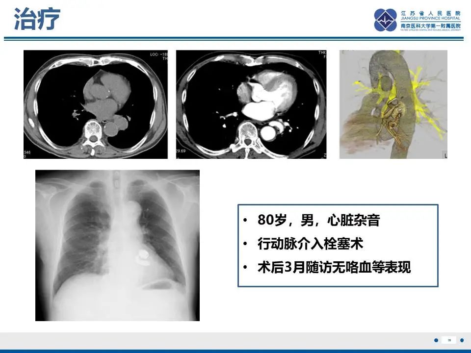 影像PPT - 【PPT】异常体循环供血左肺下叶基底段-40
