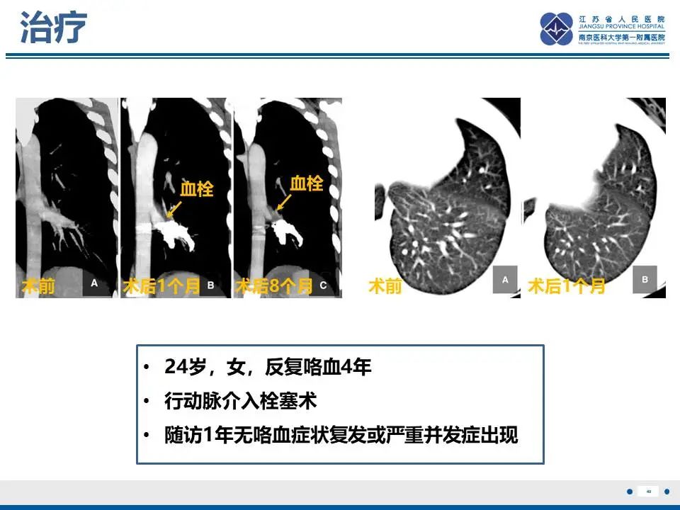 影像PPT - 【PPT】异常体循环供血左肺下叶基底段-41