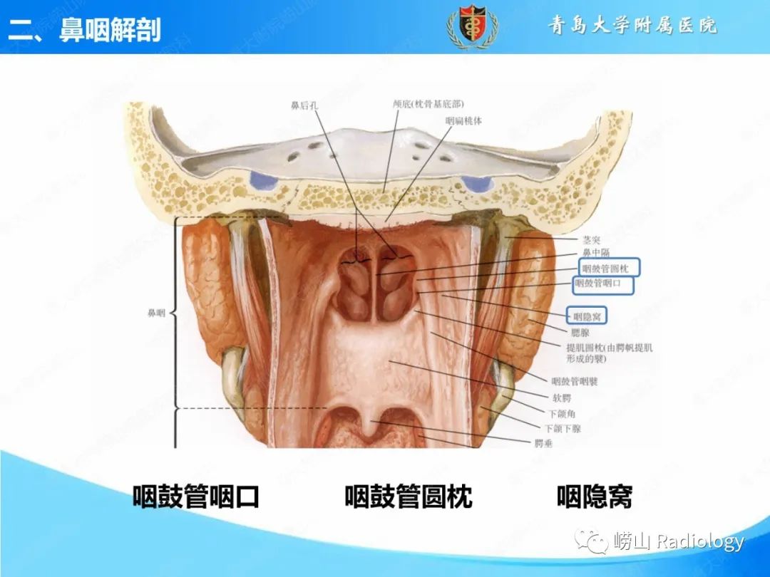 影像PPT - 【PPT】鼻咽病变的影像诊断思路-8