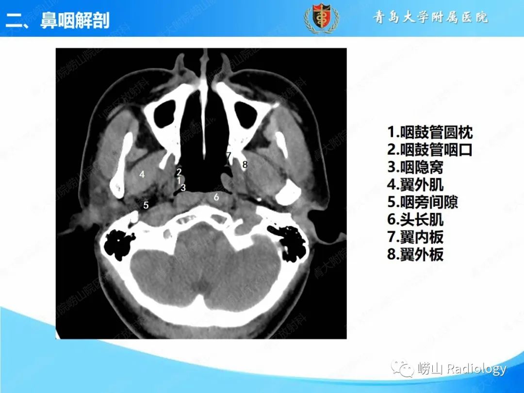 影像PPT - 【PPT】鼻咽病变的影像诊断思路-10