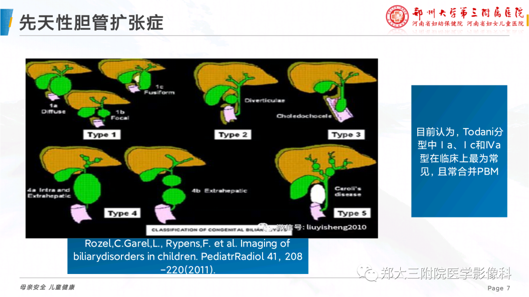 影像PPT - 【PPT】儿童胰胆管合流异常影像表现-7