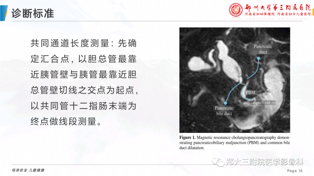 影像PPT - 【PPT】儿童胰胆管合流异常影像表现-16