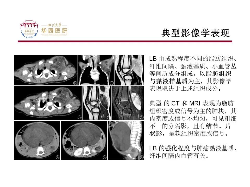 影像PPT - 【病例】脂肪母细胞瘤1例CT影像-11