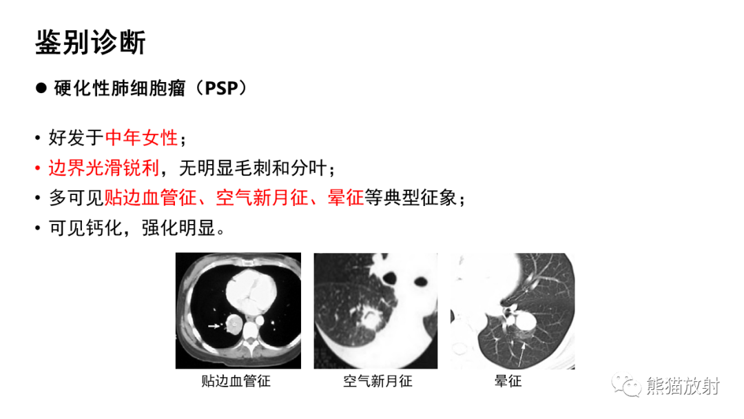 影像PPT - 【病例】肺典型类癌 VS 不典型类癌-32