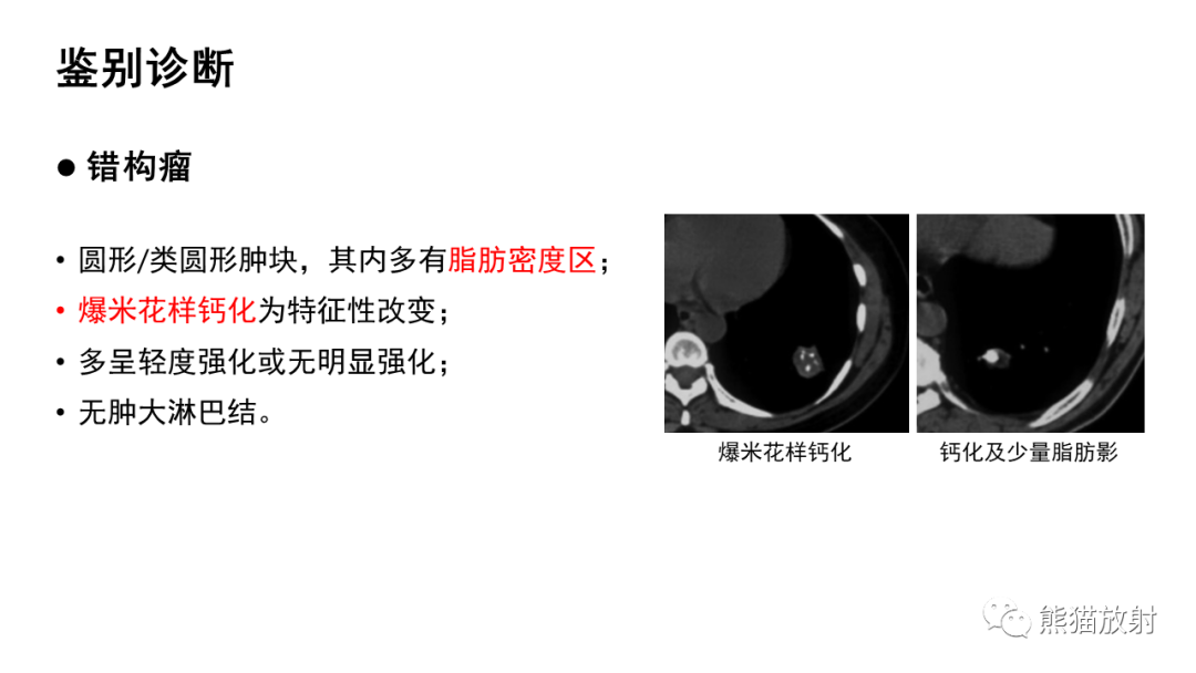 影像PPT - 【病例】肺典型类癌 VS 不典型类癌-34