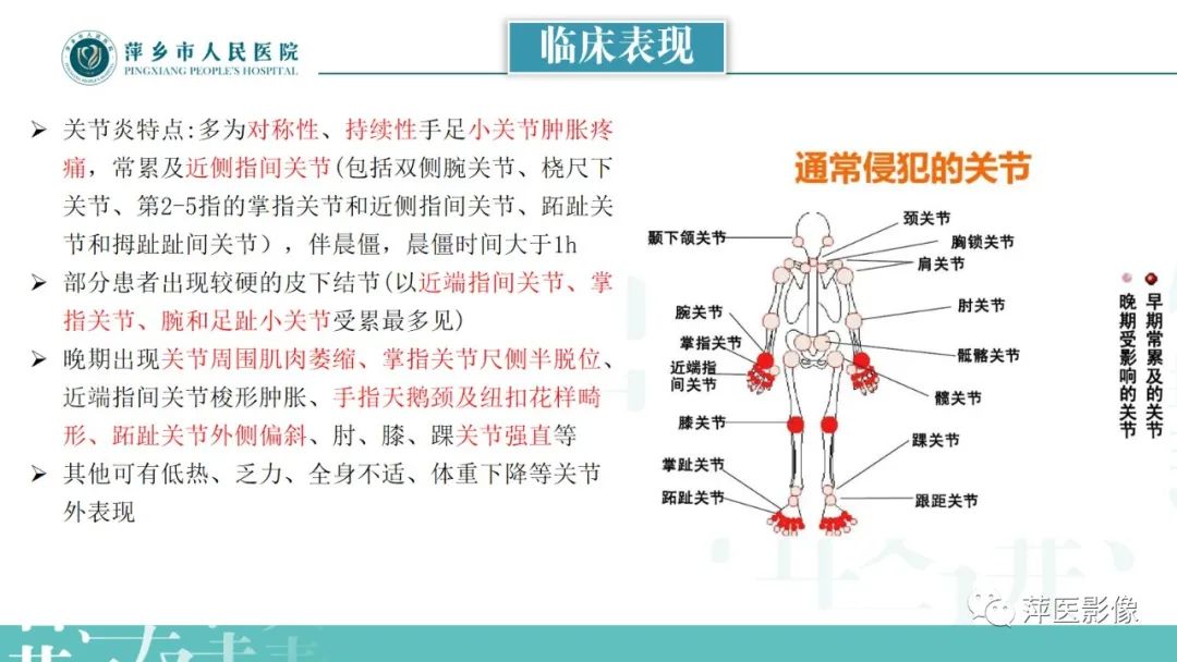 影像PPT - 【PPT】类风湿关节炎X线诊断及鉴别诊断-4