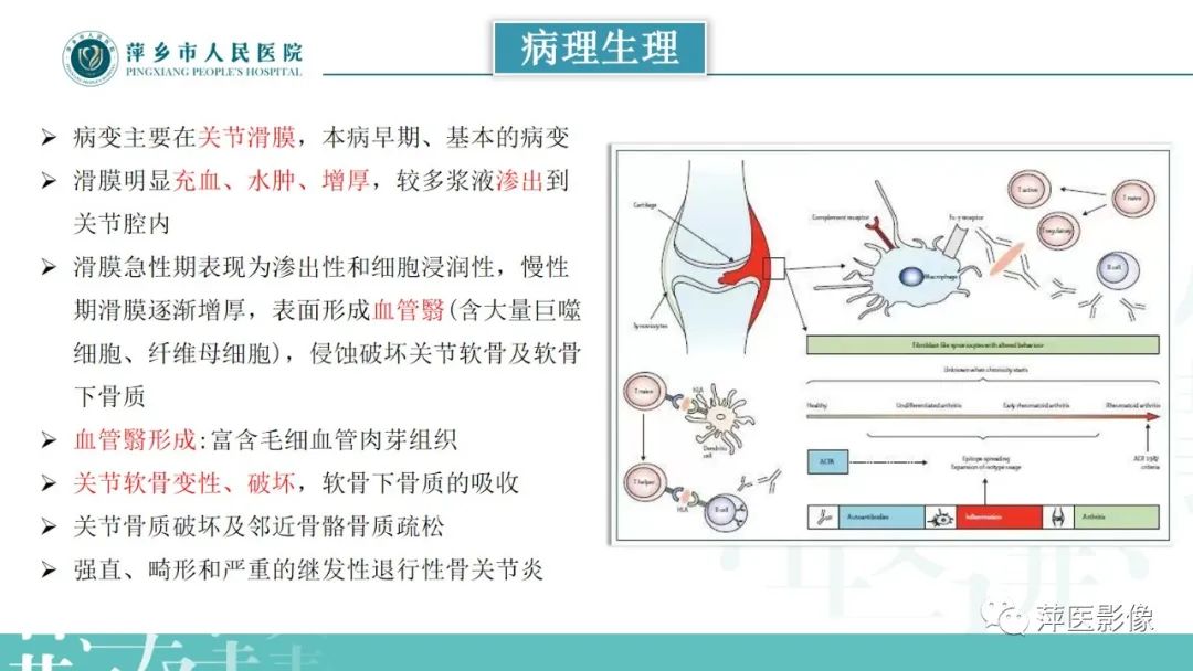 影像PPT - 【PPT】类风湿关节炎X线诊断及鉴别诊断-7