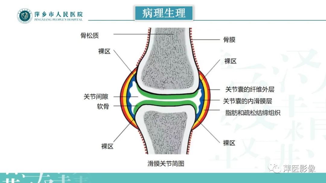 影像PPT - 【PPT】类风湿关节炎X线诊断及鉴别诊断-6