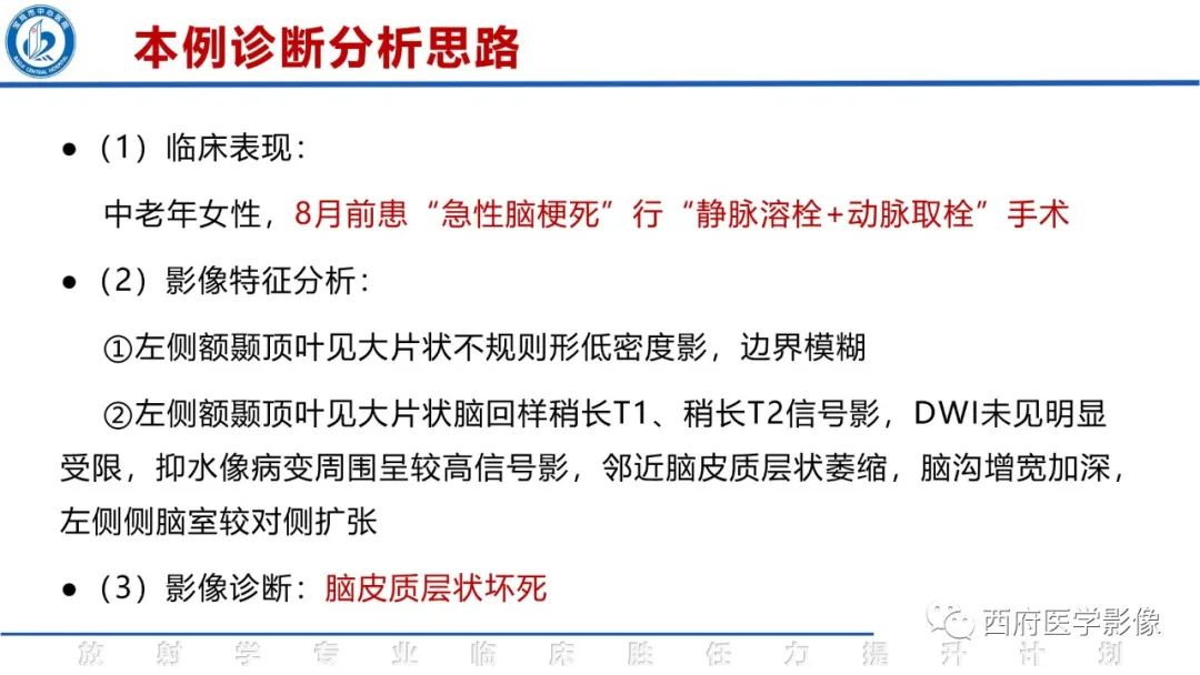 影像PPT - 【PPT】脑皮质层状坏死影像诊断与鉴别-8