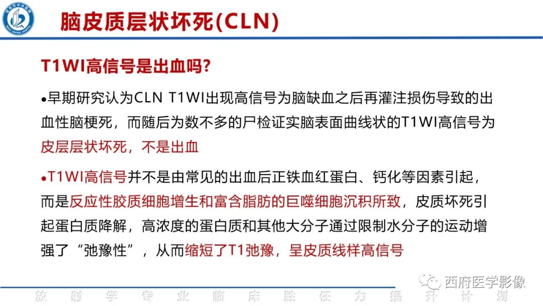 影像PPT - 【PPT】脑皮质层状坏死影像诊断与鉴别-26
