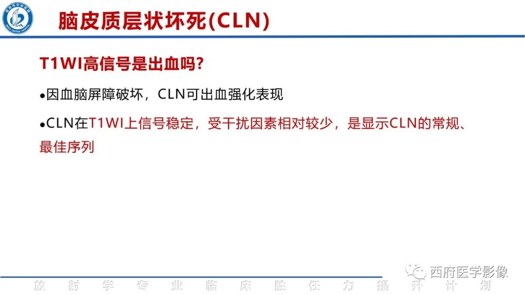 影像PPT - 【PPT】脑皮质层状坏死影像诊断与鉴别-27