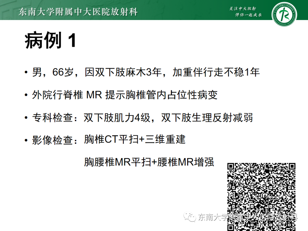 影像PPT - 【PPT】椎管内硬膜外间隙病变-1