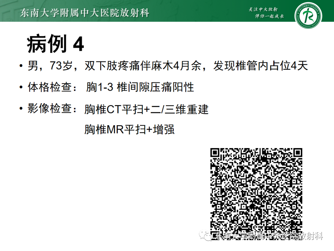 影像PPT - 【PPT】椎管内硬膜外间隙病变-9