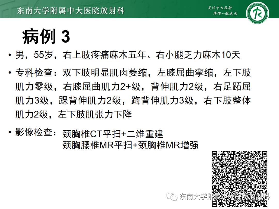 影像PPT - 【PPT】椎管内硬膜外间隙病变-6