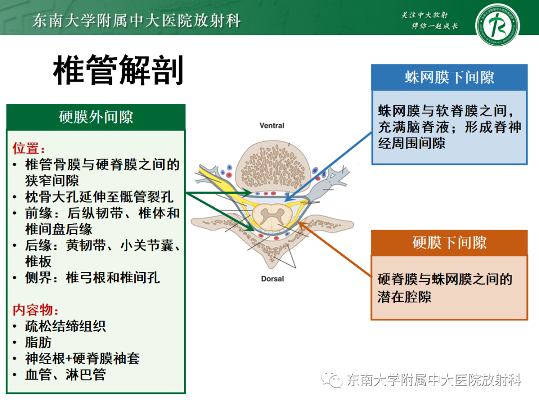 影像PPT - 【PPT】椎管内硬膜外间隙病变-21